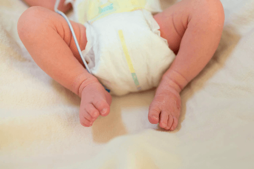 Hypospadias treatment cost