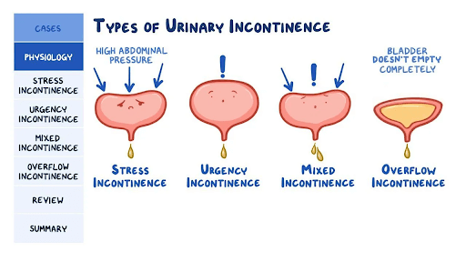 types of urinary incontinence
