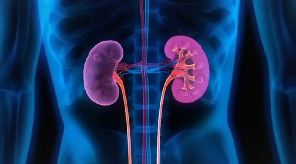 علاج سرطان الكلى المنتشر