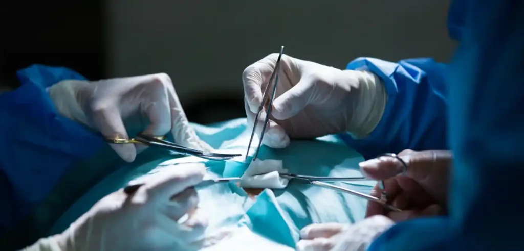 عملية استئصال ورم الخصية - مركز البروفيسور السامرائي الطبي في دبي استشاري المسالك البولية عملية استئصال ورم الخصية