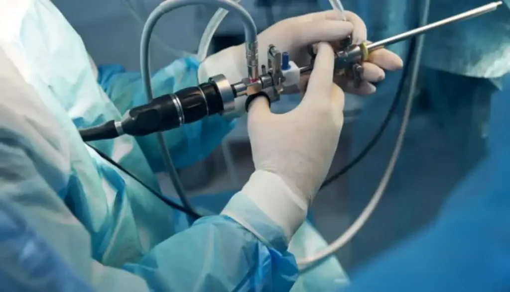 هل منظار المثانة مؤلم