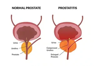 Prostate Cancer Consultant in Dubai | Expert Diagnosis & Treatment 3 prostate cancer consultant dubai