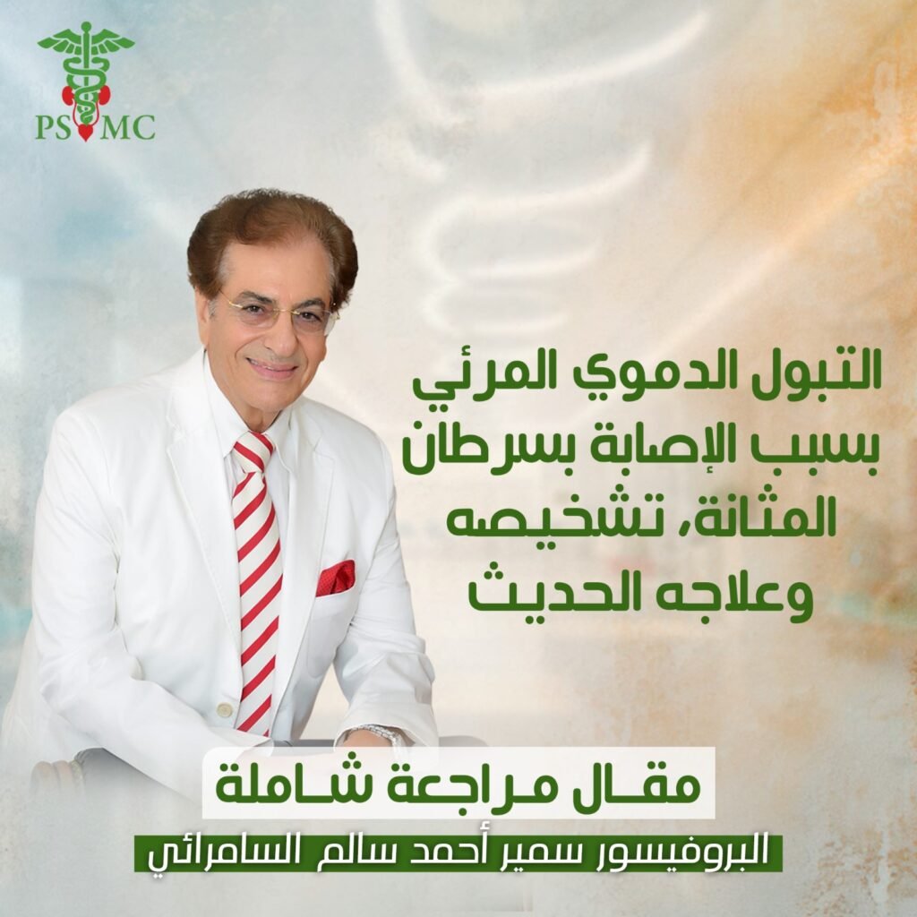 التبول الدموي المرئي بسبب الإصابة بسرطان المثانة، تشخيصه وعلاجه الحديث