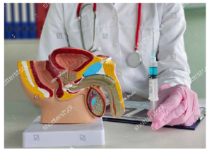 prostate cancer treatment in dubai