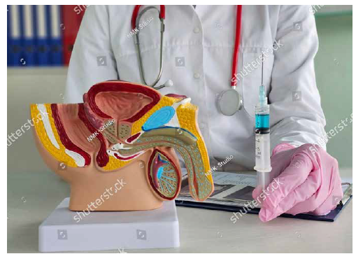 Prostate Cancer Hormonal therapy Comprehensive Review Article Part 6