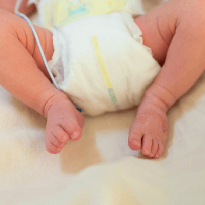 Hypospadias treatment cost