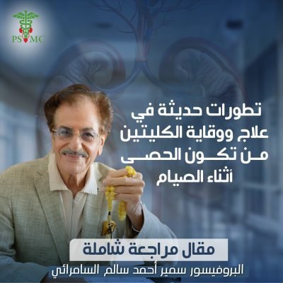 تطورات حديثة في علاج ووقاية الكليتين من تكون الحصى أثناء الصيام