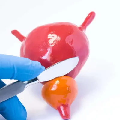 benign prostatic enlargement