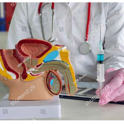 Prostate Cancer Hormonal therapy Comprehensive Review Article Part 6