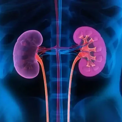 علاج سرطان الكلى المنتشر