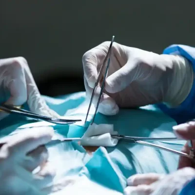 عملية استئصال ورم الخصية