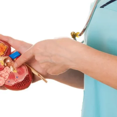 كم تستغرق عملية حصى الحالب بالمنظار