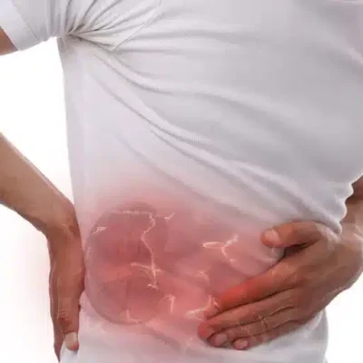 كيفية التخلص من الحصوة في الحالب