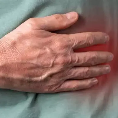 نسبة الشفاء من سرطان المثانة