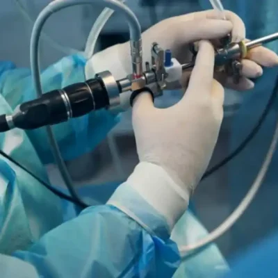 هل منظار المثانة مؤلم